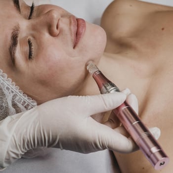 Microneedling-1 Microneedling-1